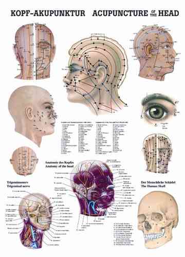 Kopfakupunktur